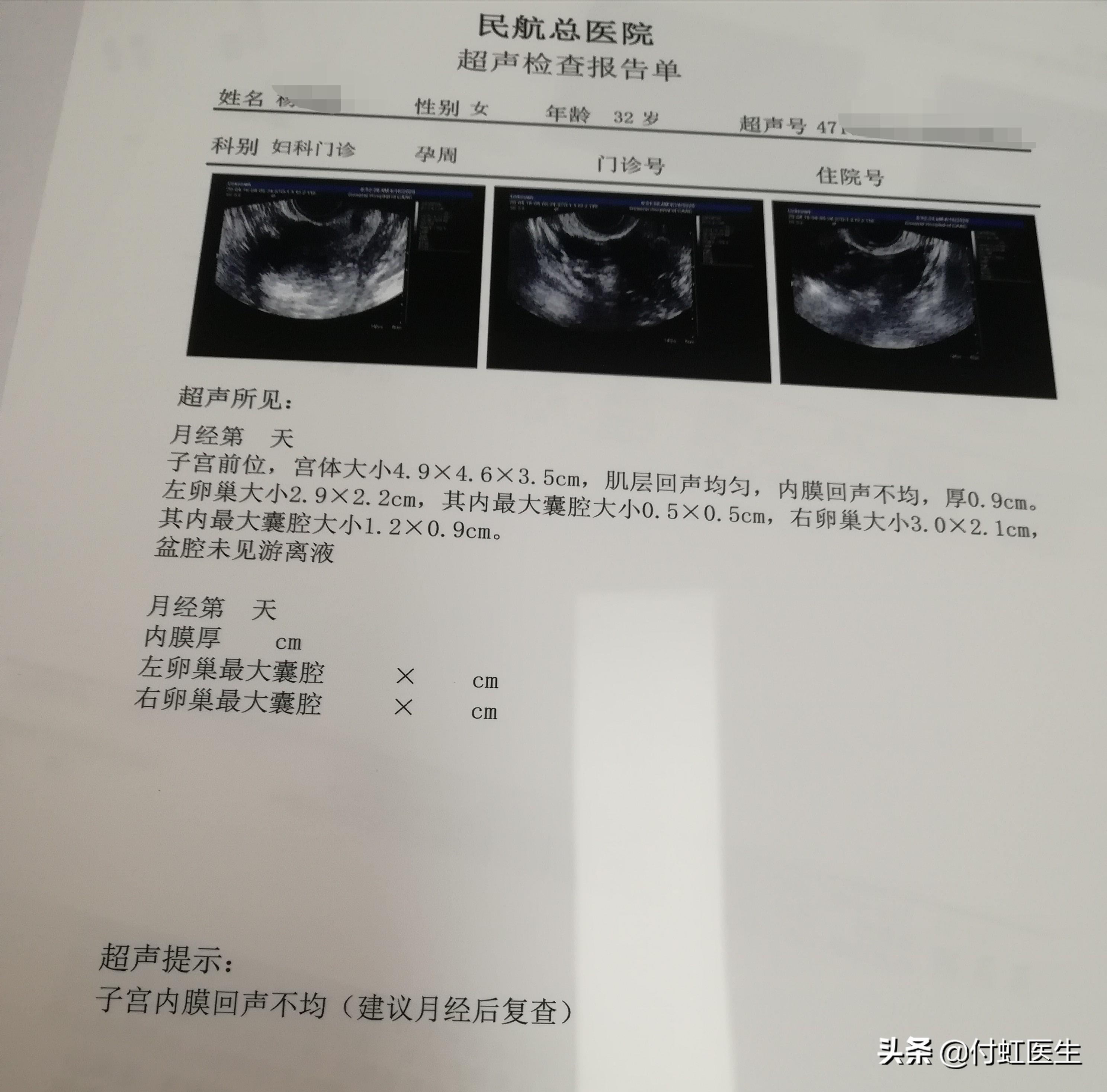 最新B超單，解讀孕期胎兒健康狀況的關鍵所在